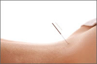 acupuncture treatment for back pain